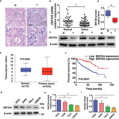 A Novel ZNF304/miR-183-5p/FOXO4 Pathway Regulates Cell Proliferation in Clear Cell Renal Carcinoma